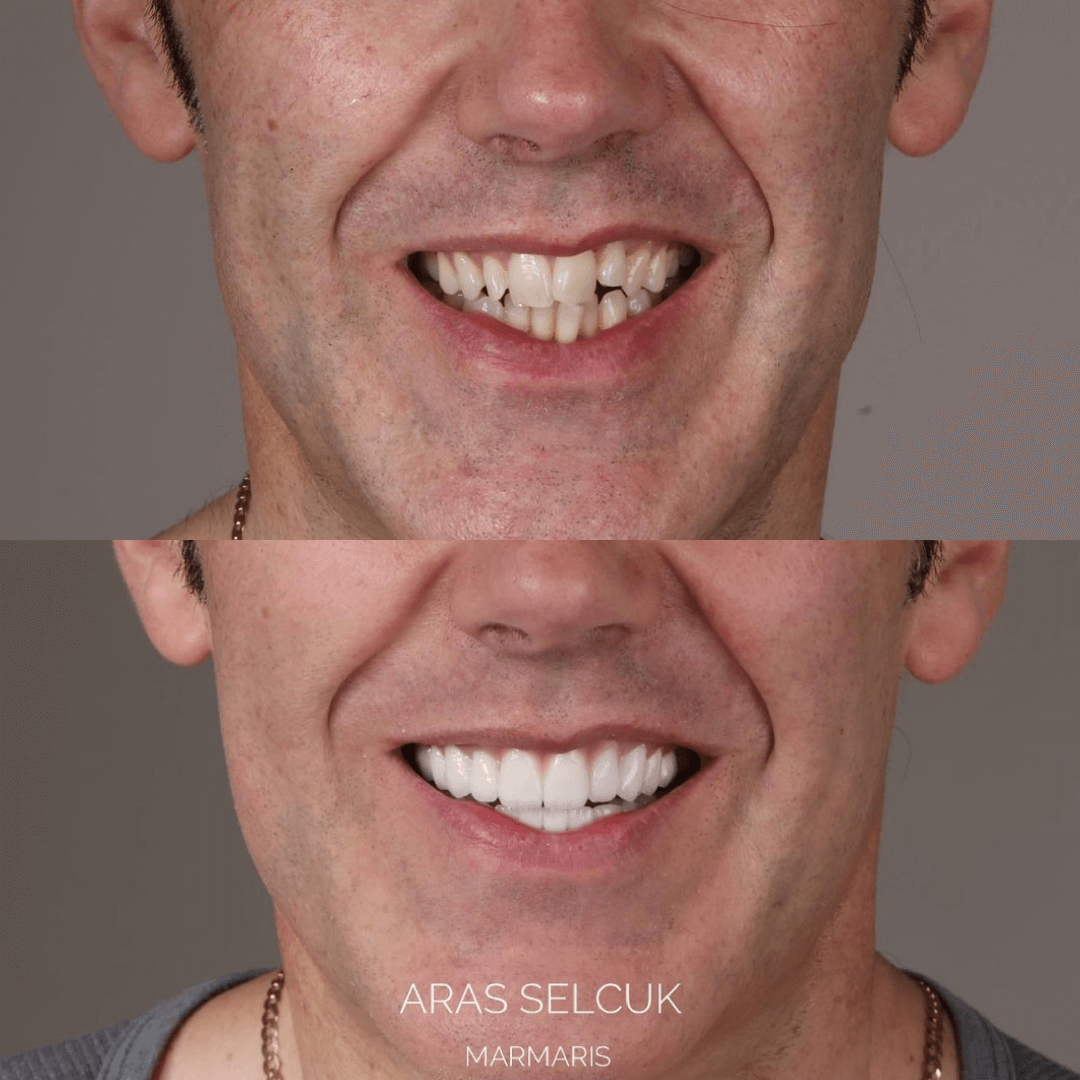 Dental clinic in Marmaris