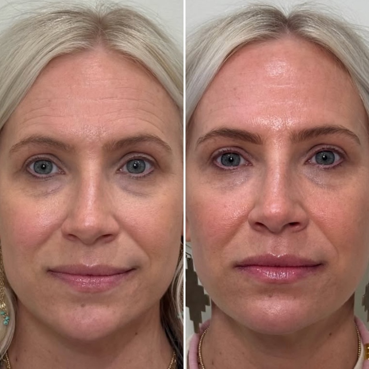 Peptide Power 8 і ретинол у догляді
