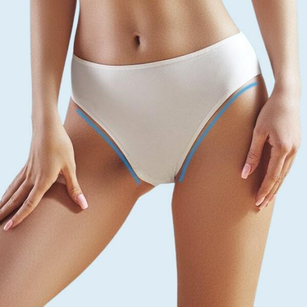 Інтимна пластика (intimate plastic)