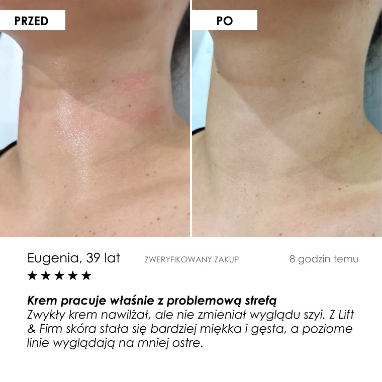 Przed i po: Eugenia, 39 lat — opinia klientki