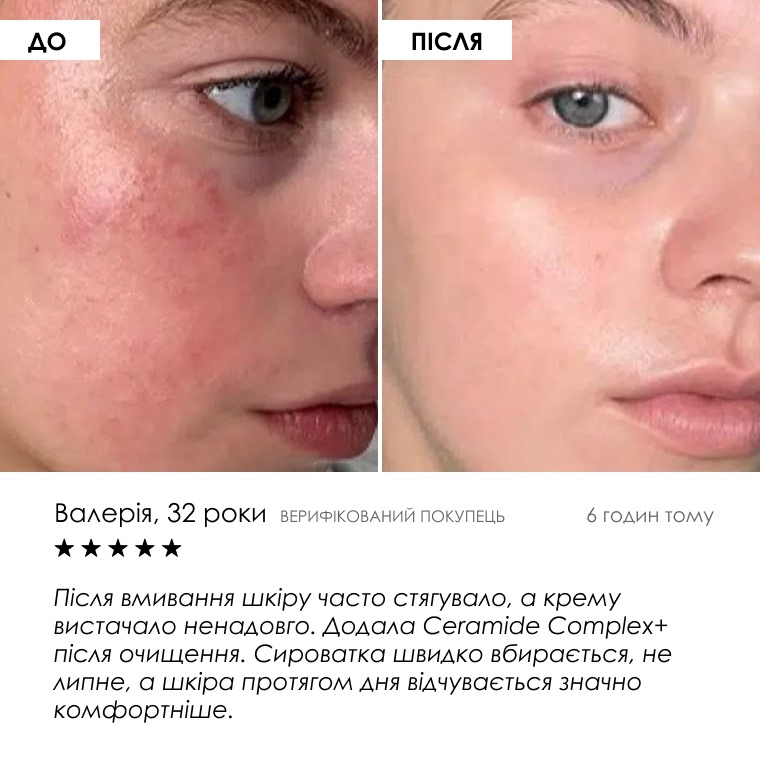 Сироватка Ceramide Complex+ — фото 6 з 9