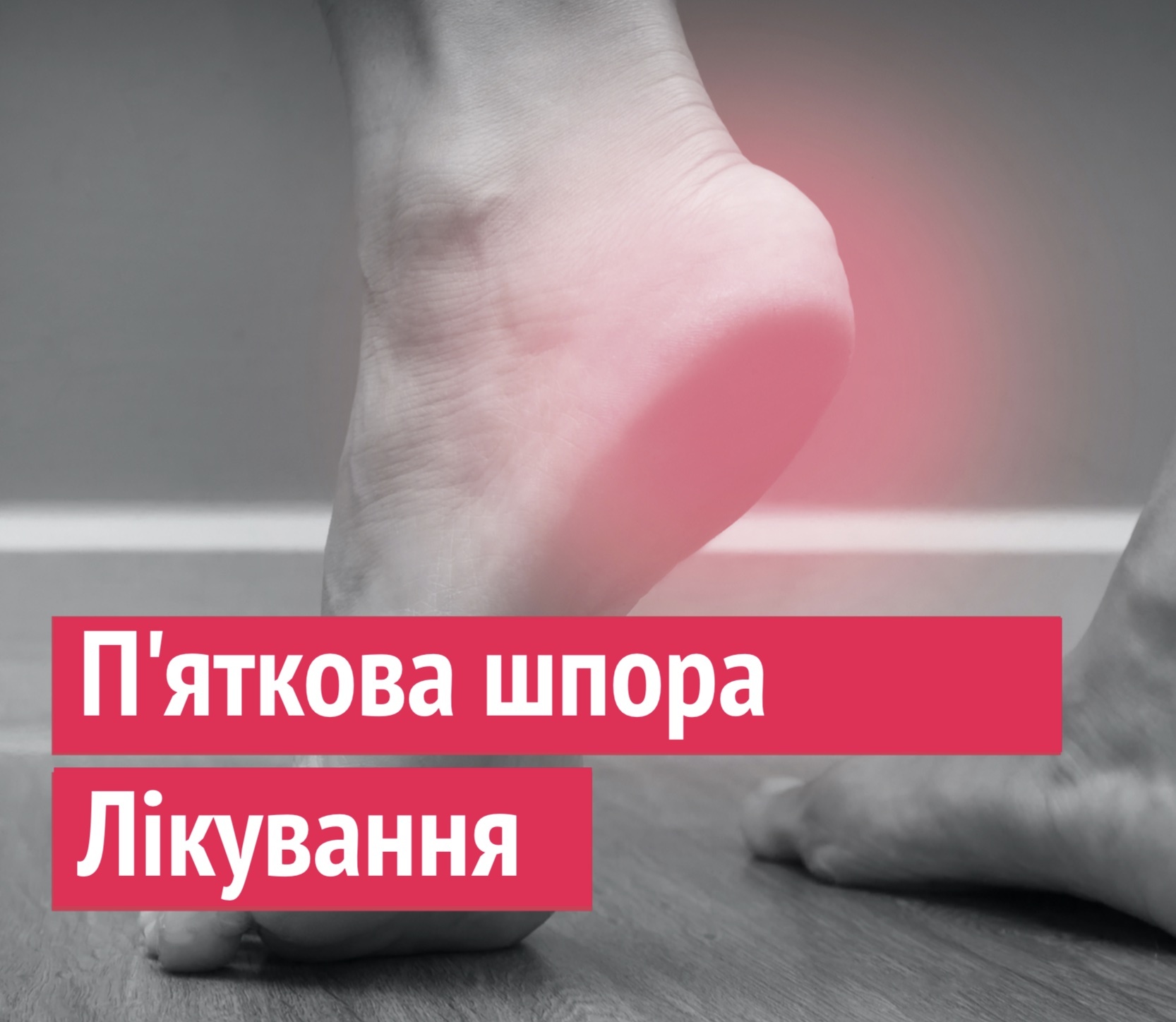 П`яткова шпора. Лікування