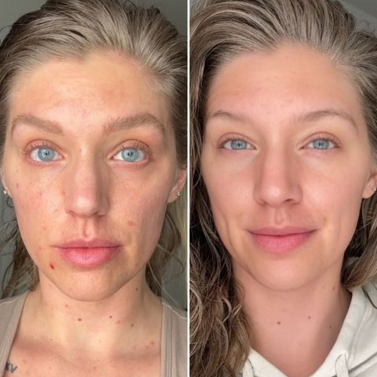 до та після — Аліна, 34