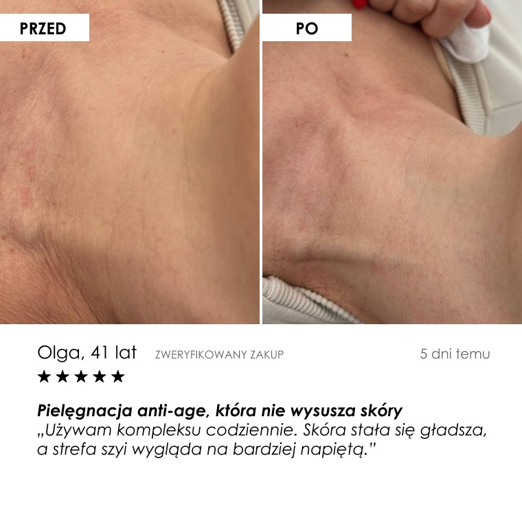 Przed i po: Olga, 41 lat — opinia klientki