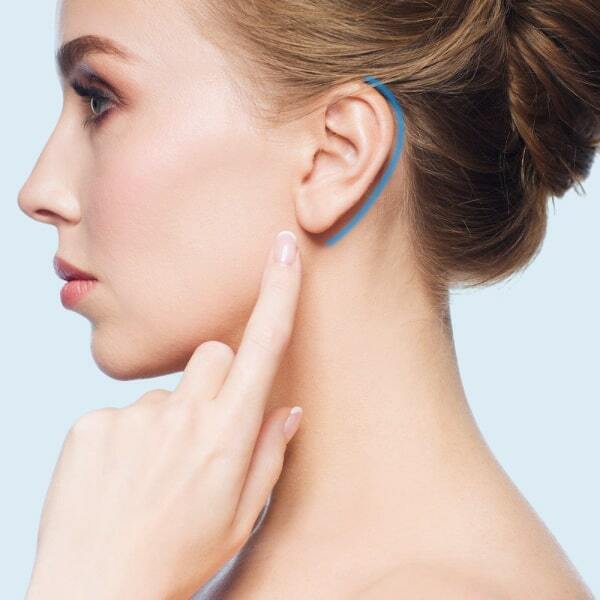 Отопластика (otoplasty)