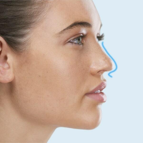 Ринопластика (rhinoplasty)