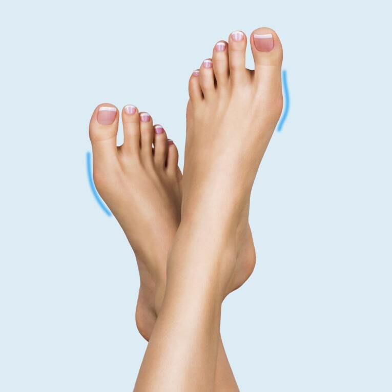 Лікування Халюс вальгус (кісточка на ногах)