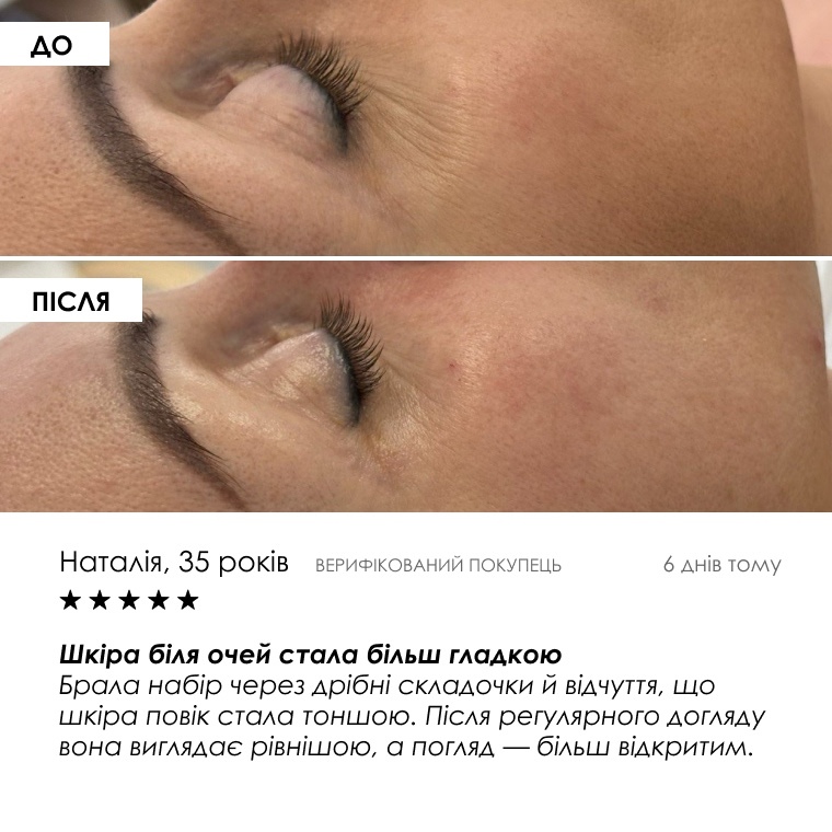 Інтенсивний комплекс проти «гусячих лапок» — сироватка 20 g і крем 35 g, фото 6 з 9
