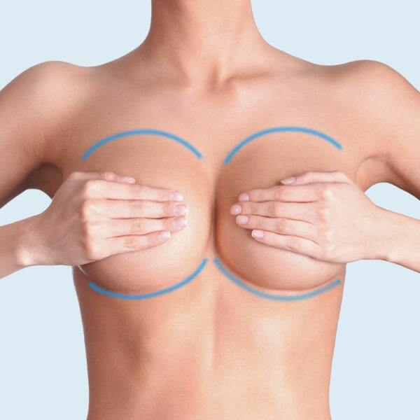 Маммопластика