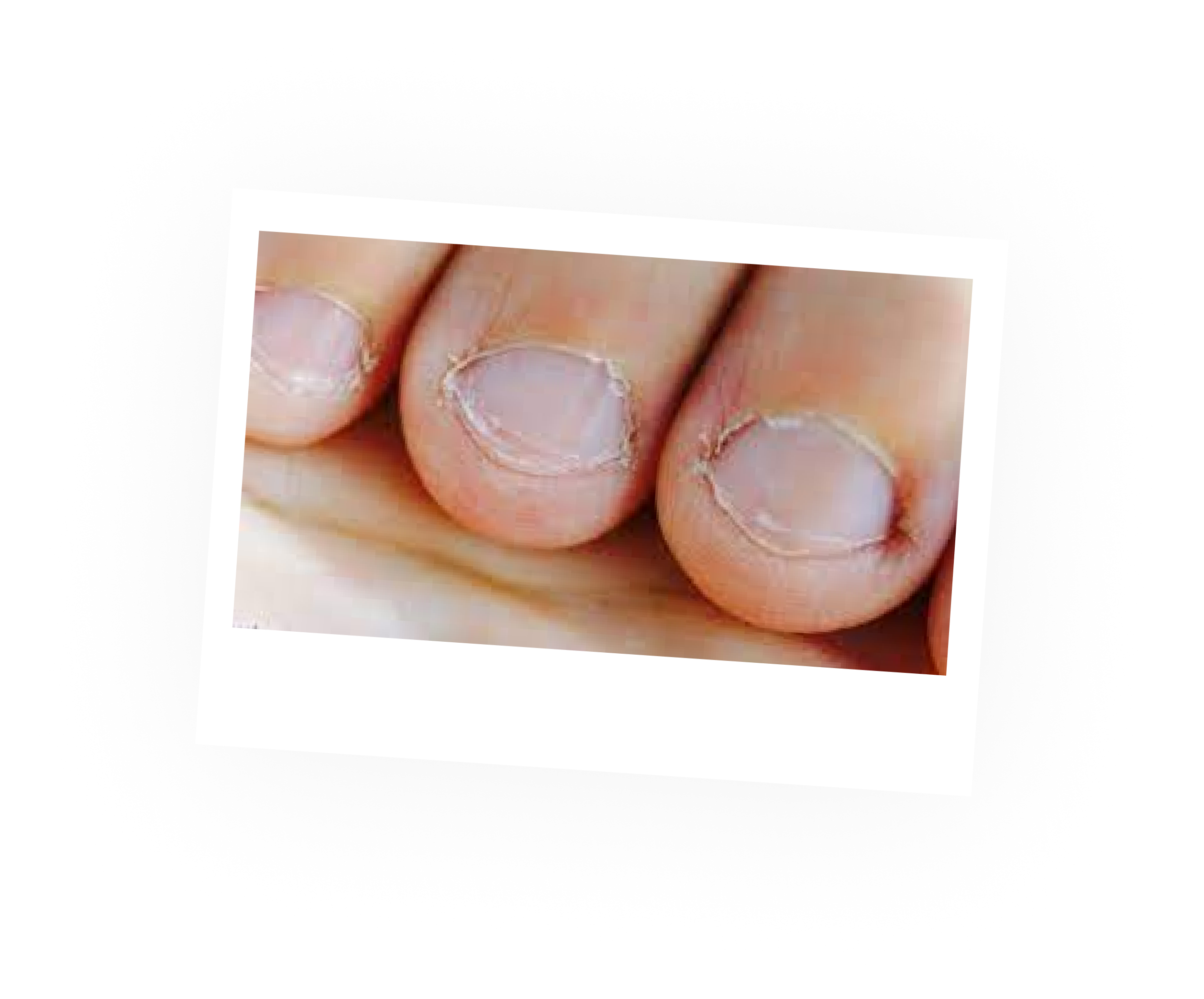 Gel unghie, tecniche per la rimozione fai da te - Cesvim Academy