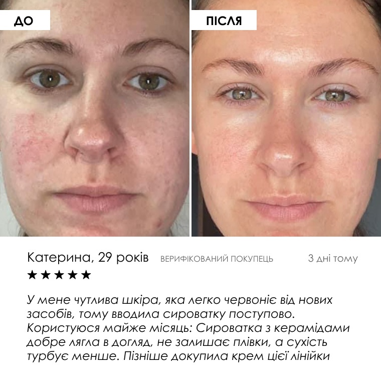 Сироватка Ceramide Complex+ — фото 7 з 9