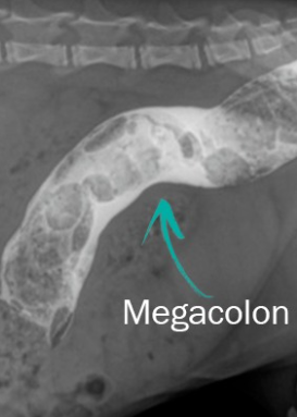Figura 2: La radiografía reveló megacolon