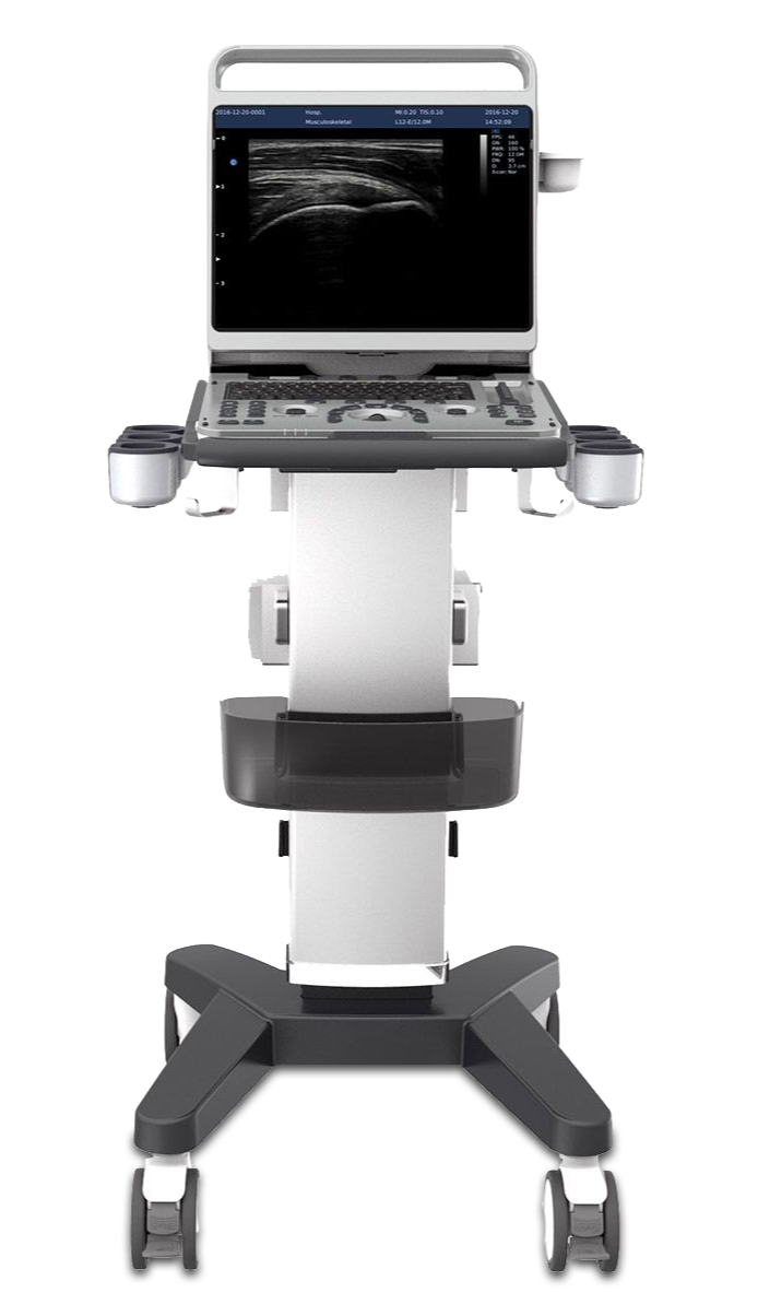 chison ultrasəs almaq