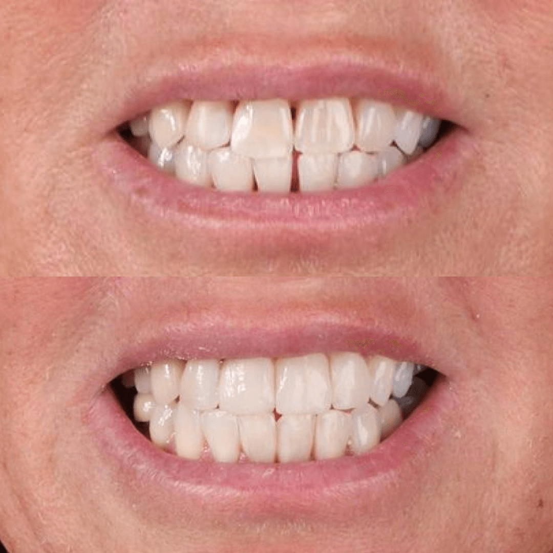 Dental treatment in Turkey