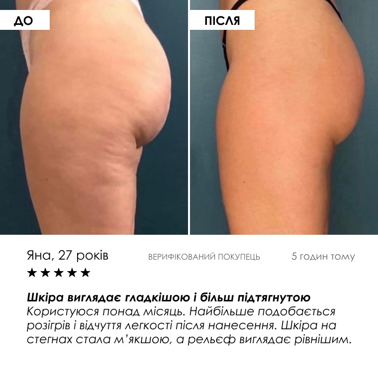 HOT Cream Anti-Cellulite — результати