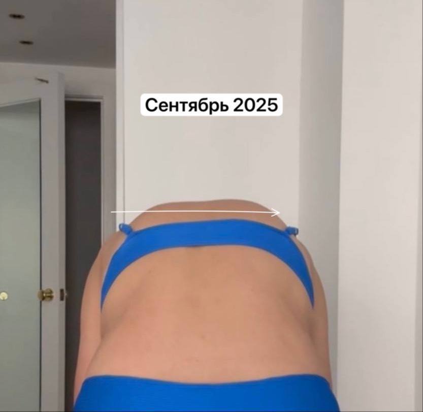 Фото результата 02 — Case 06