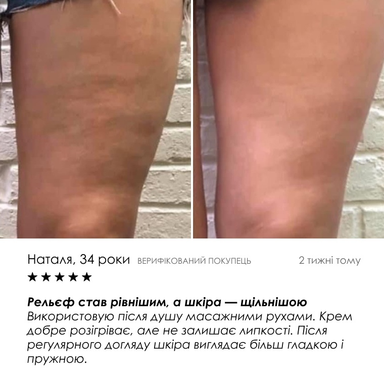 HOT Cream Anti-Cellulite — як застосовувати