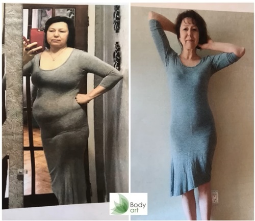 Видео отзыв Body Art — результат до и после