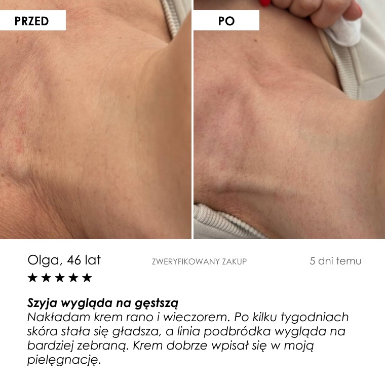 Przed i po: Olga, 46 lat — opinia klientki