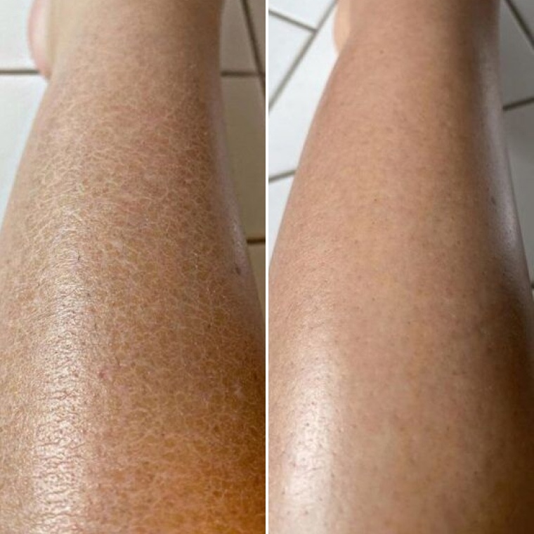 до та після — Ірина, 37