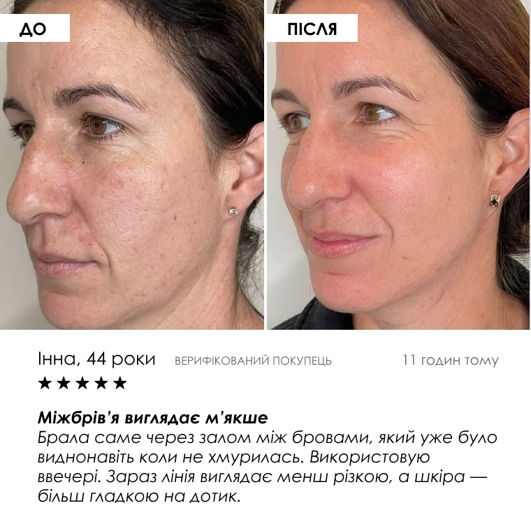 Нанесення сироватки у вечірньому догляді