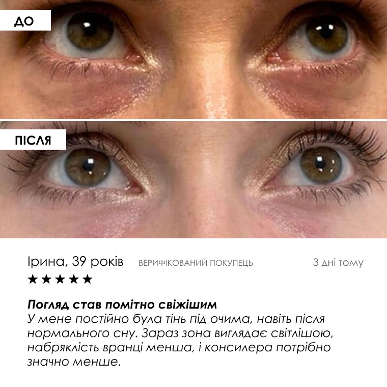 Зони застосування набору