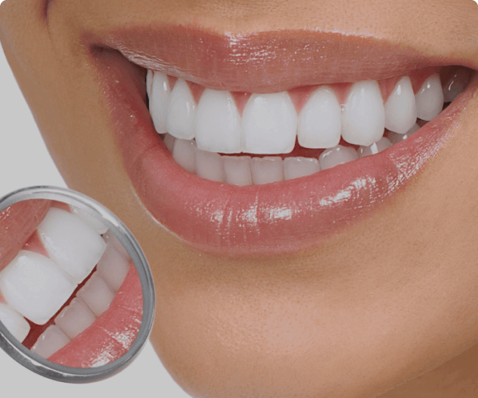 White teeth after dental treatment
