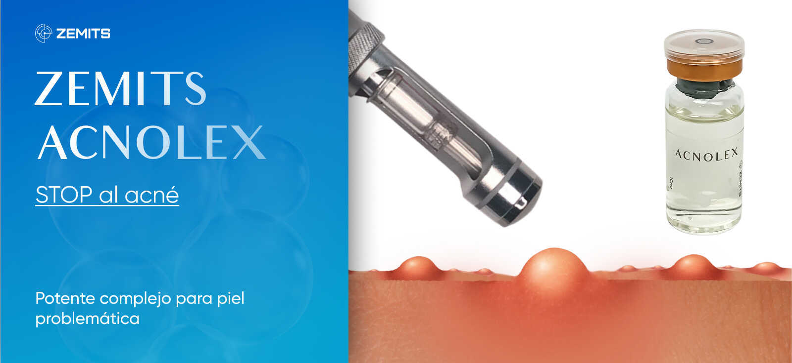Zemits Acnolex Suero anti-acné para mesoterapia sin agujas