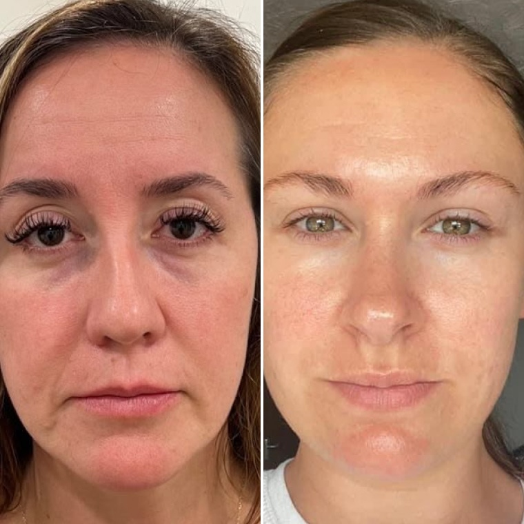 Peptide Power 8 — питання про milky