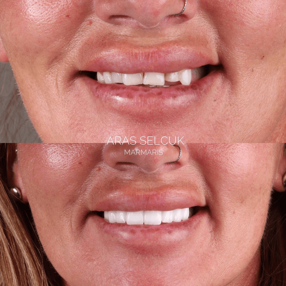 Best dentist in Marmaris