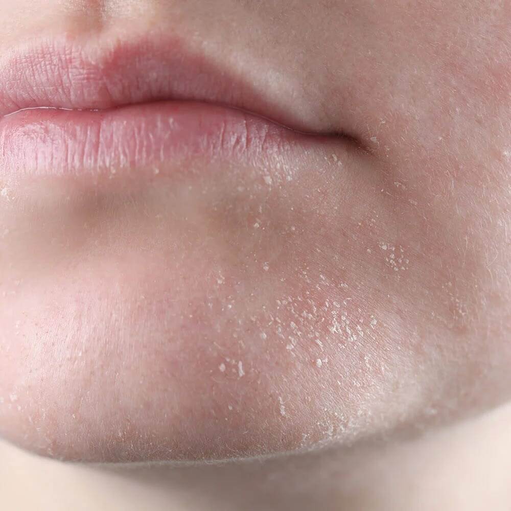 Вибір між milky-тонером і Peptide Power 8