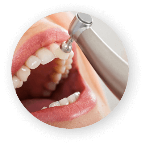 Чистка верхних зубов 