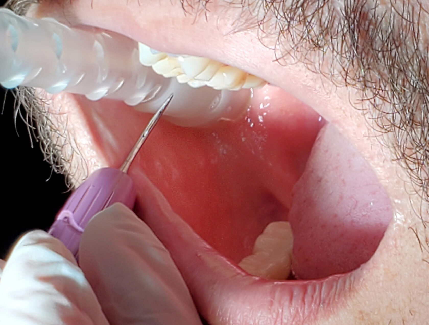 Advanced Dental Suction