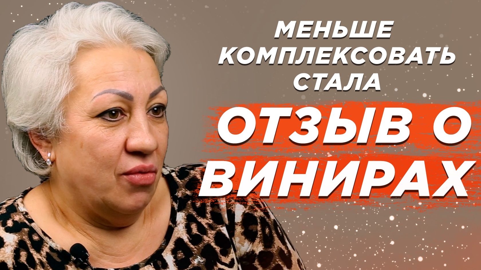 Отзывы о винирах