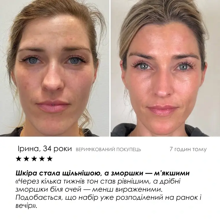 Age Reset Kit — кадр 7
