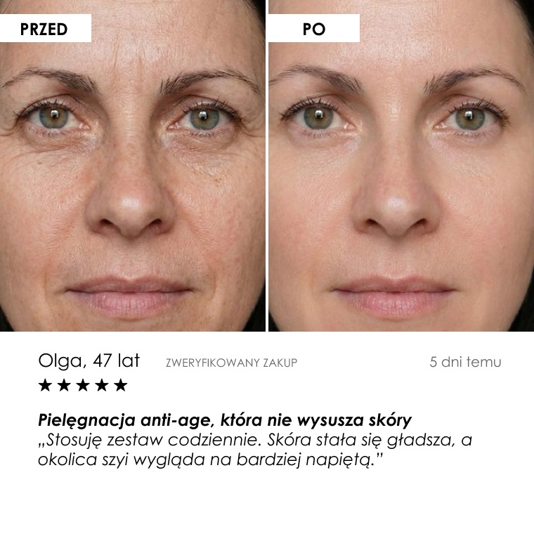 Serum ARGIRELINE® — flakon 30 ml