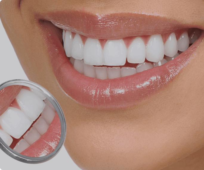 White teeth after dental treatment