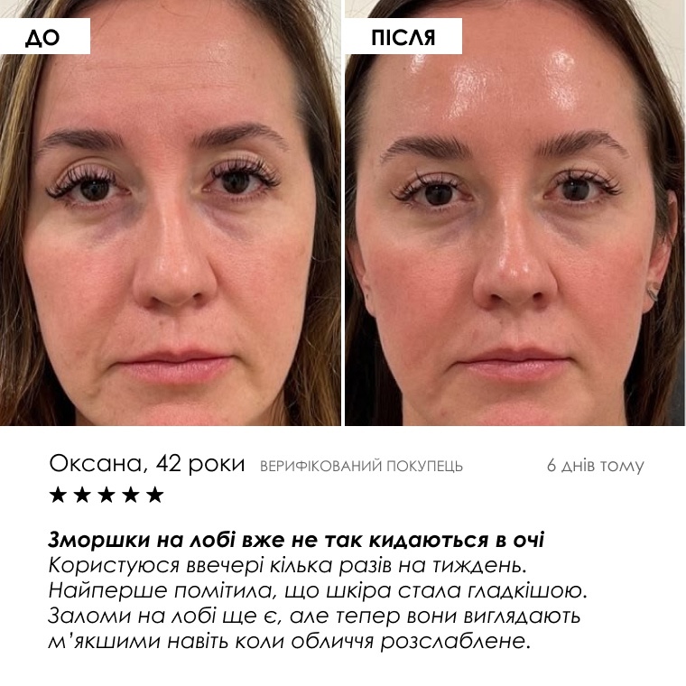 Схема вечірнього використання сироватки