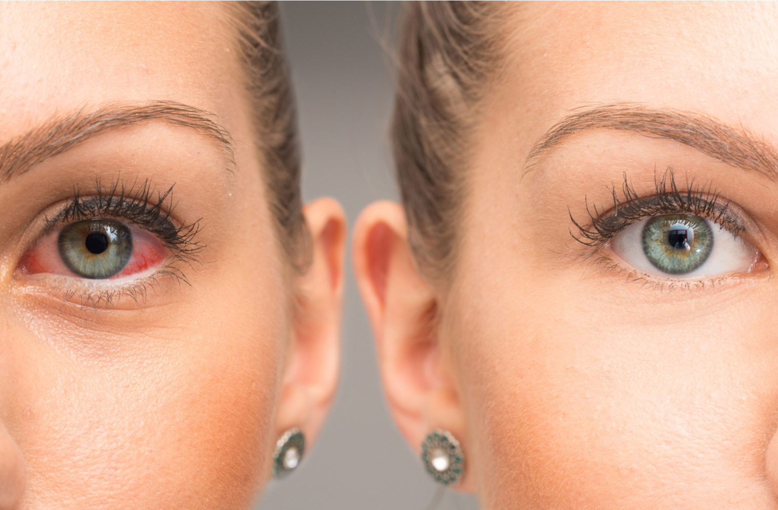 increase skin moisture