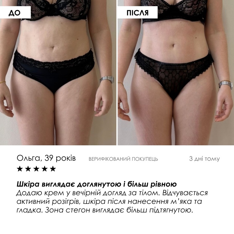 HOT Cream Anti-Cellulite — щоденний ритуал