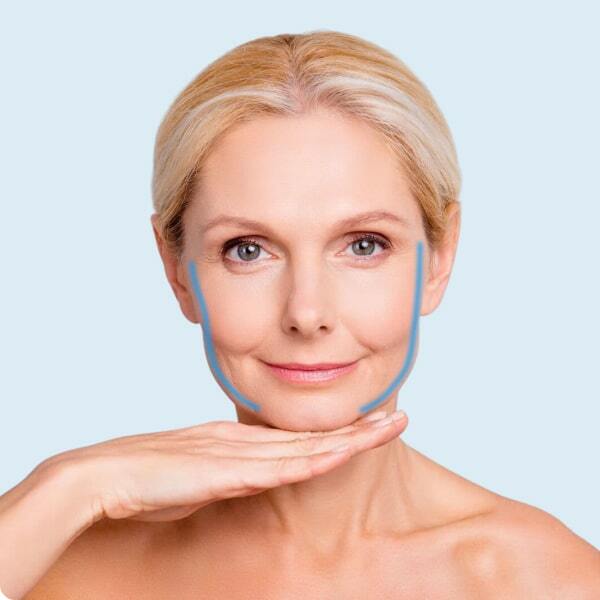 Підтяжка обличчя (face lifting)