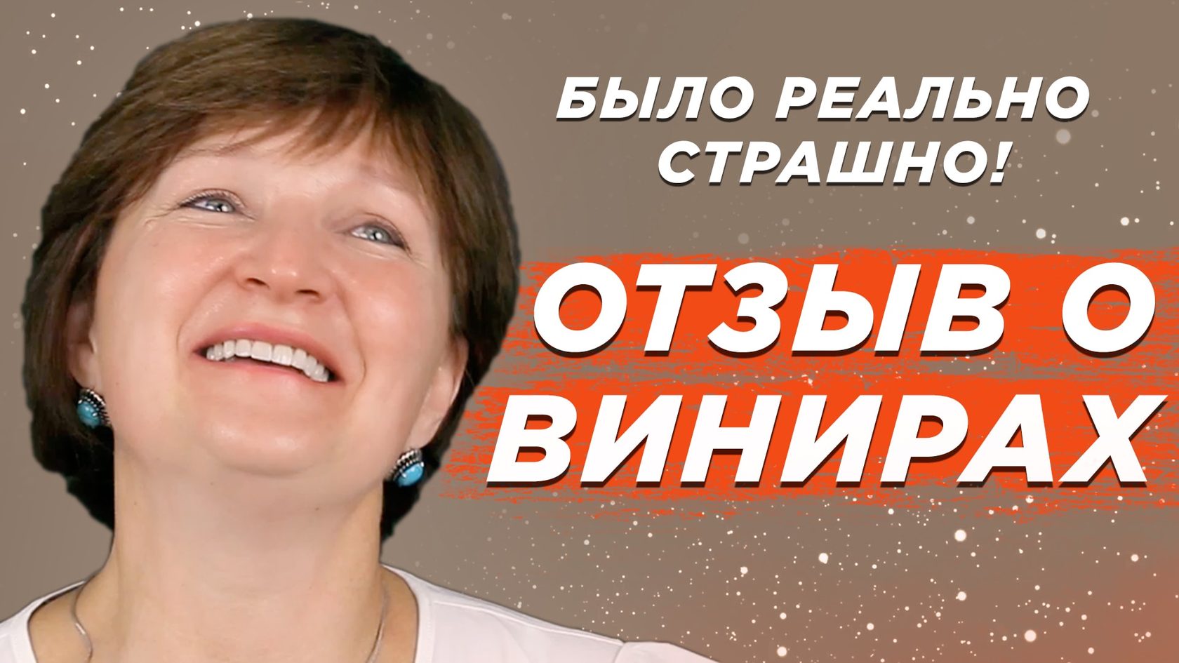 Отзывы о винирах