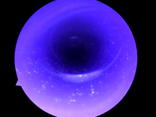 Endoscope Capture with USB Camera