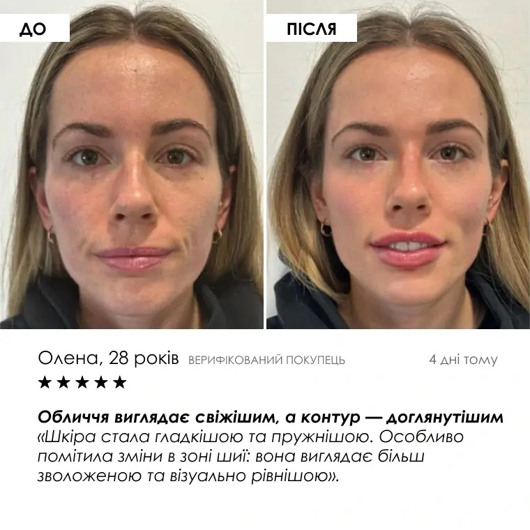 Age Reset Kit — кадр 8
