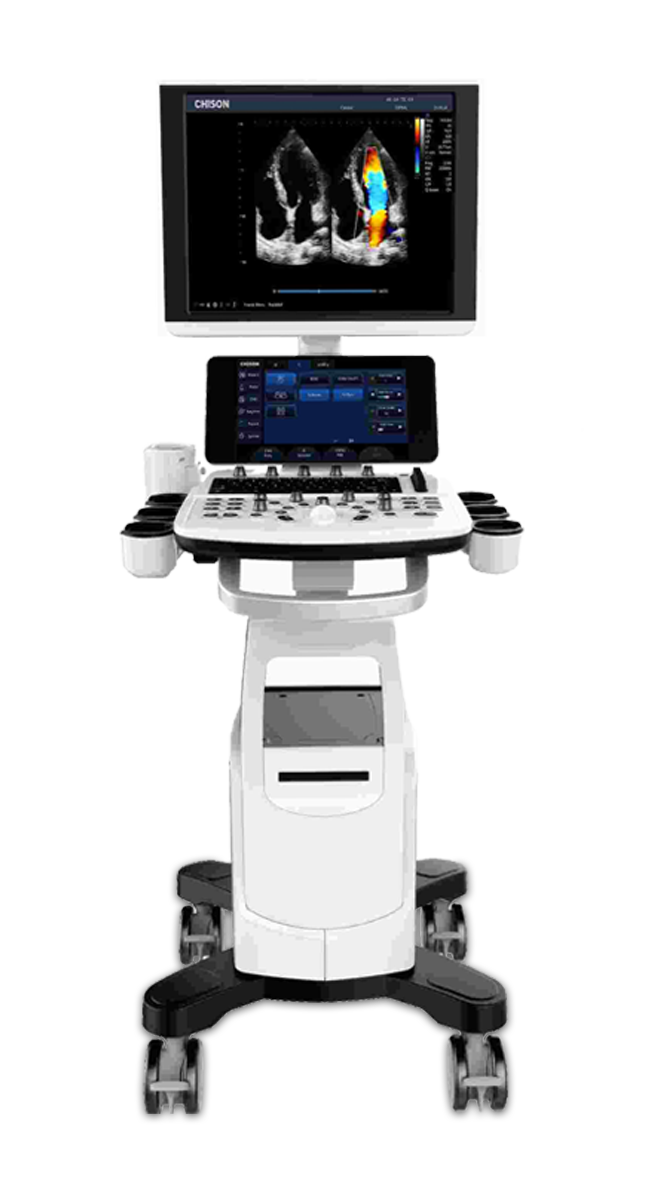 chison ultrasəs cihazı