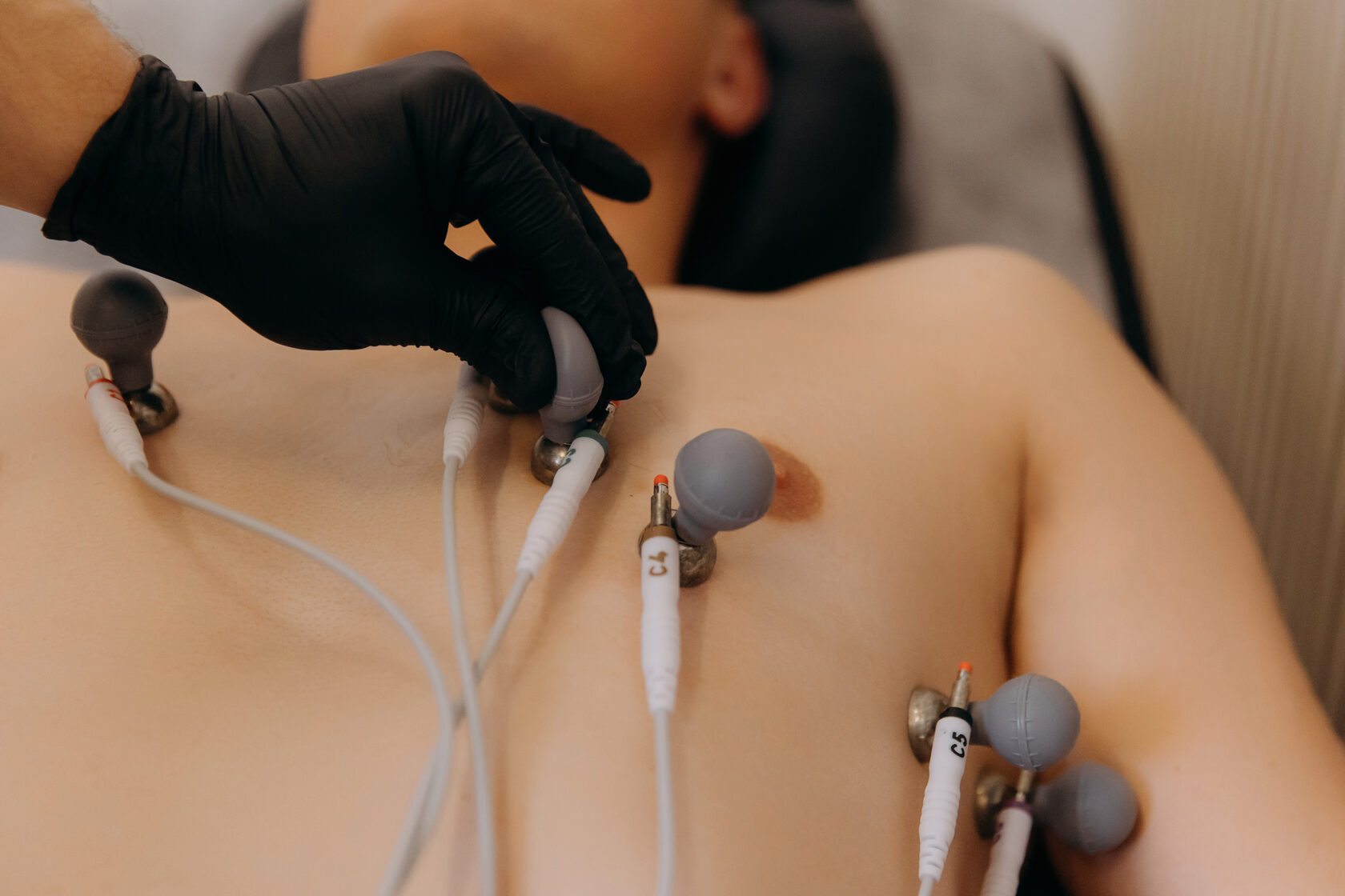 флебологія та судинна хірургія