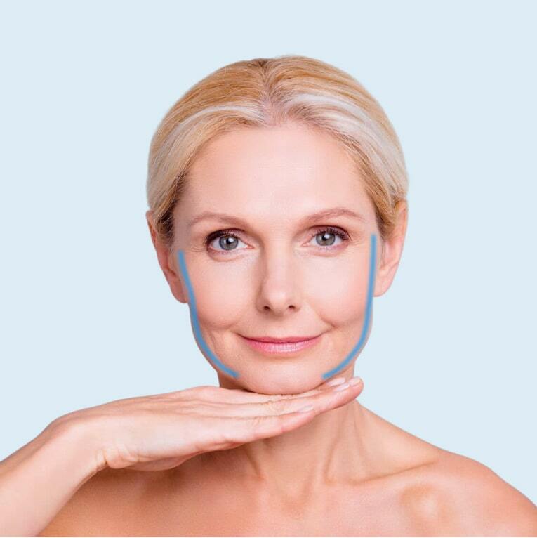 Підтяжка обличчя фейсліфтинг