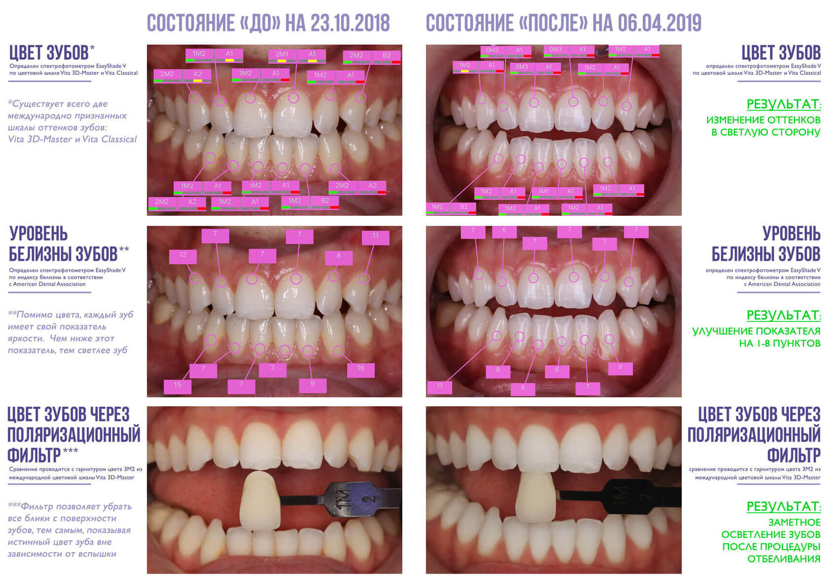 Паспорт цвета зуба