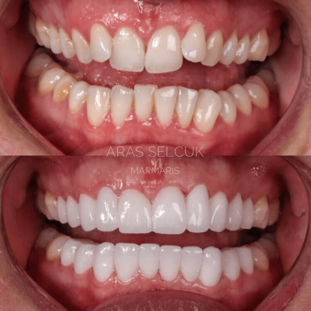 Aras Selcuk Advanced Dentistry clinic in Marmaris