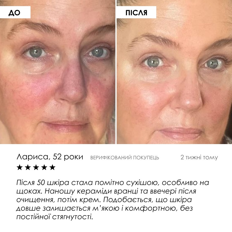 Сироватка Ceramide Complex+ — фото 8 з 9